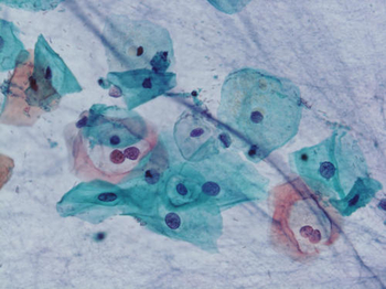 細胞診の顕微鏡像