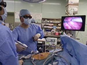3Dモニターを使用した腹腔鏡手術2